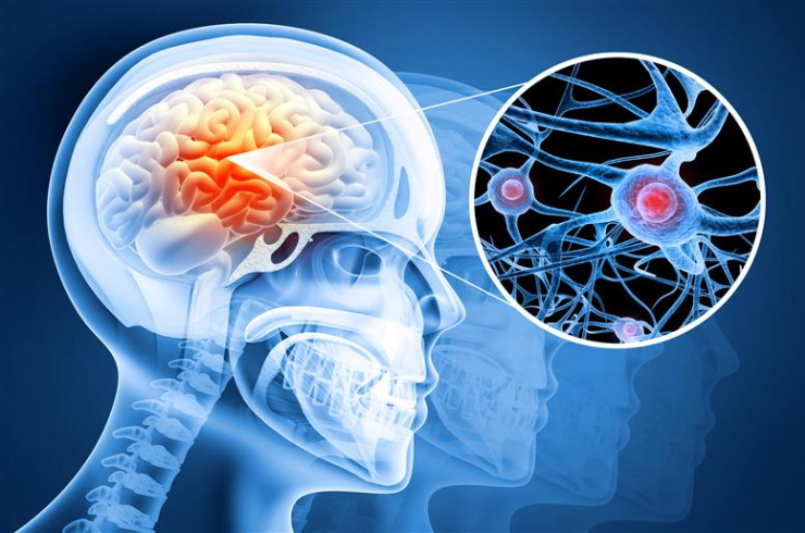 brain injury